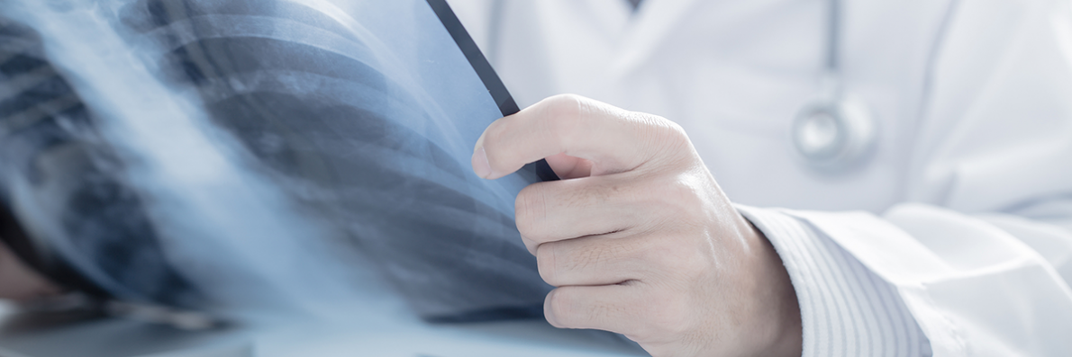 Nätverk personskador